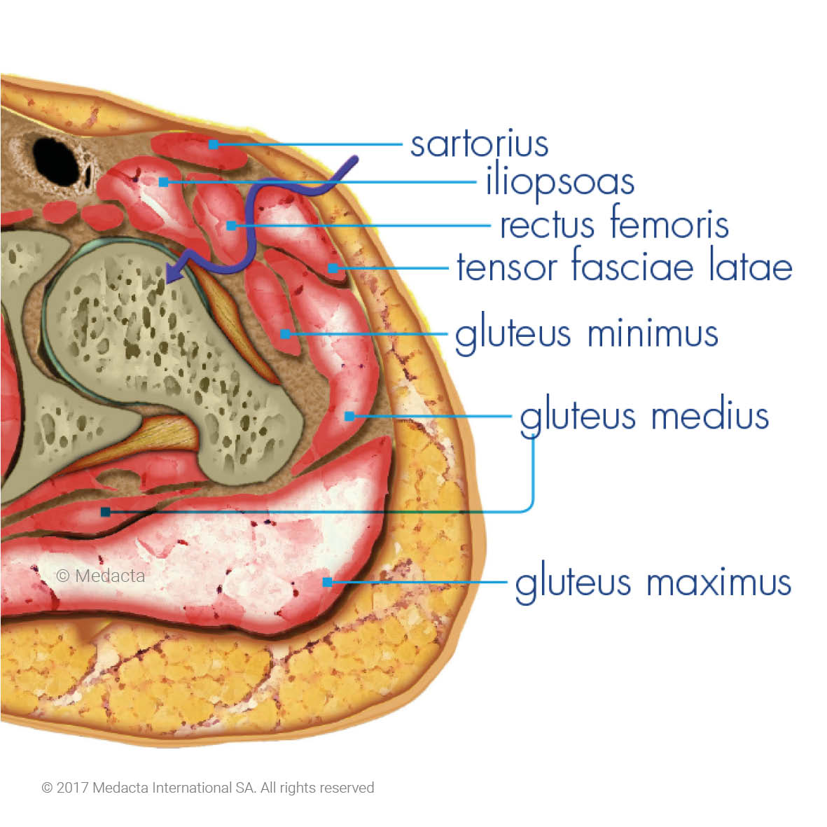 direct-anterior-approach-photo-1